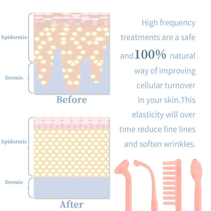 Lucie Luxe™ High Frequency Skin Therapy Machine